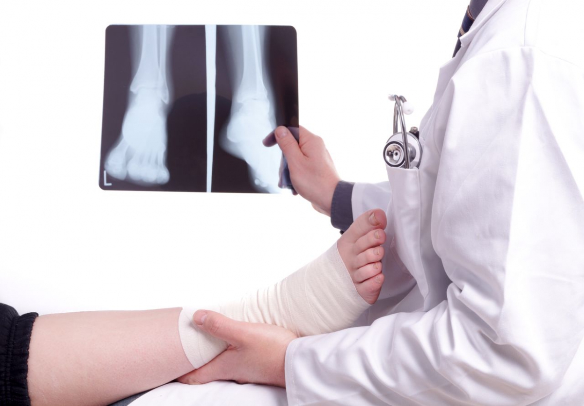 Как диагностировать перелом ноги или пальца на ноге? Доврачебная помощь при переломе ноги и пальцев ног