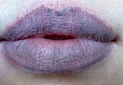 Почему у ребенка синеют губы 4 года thumbnail