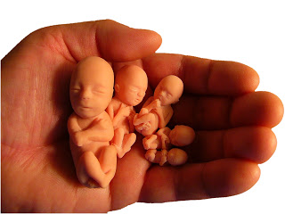 Мини-аборт. Плюсы и минусы