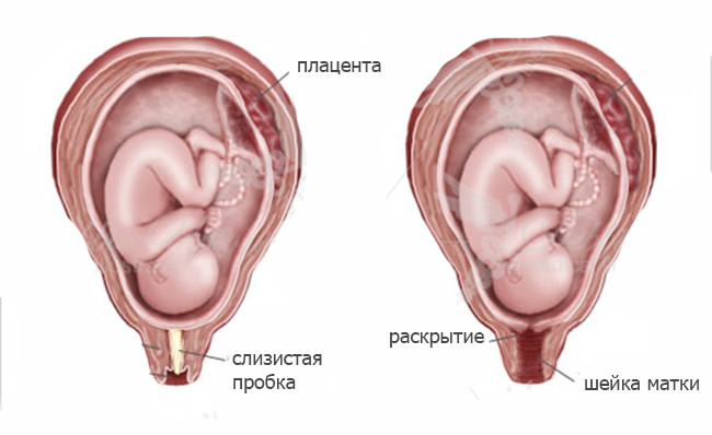 отхождение пробки