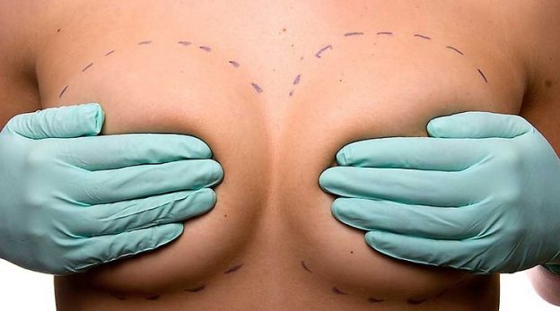 Удаление груди - шанс на жизнь. Консультация хирурга-онкогинеколога