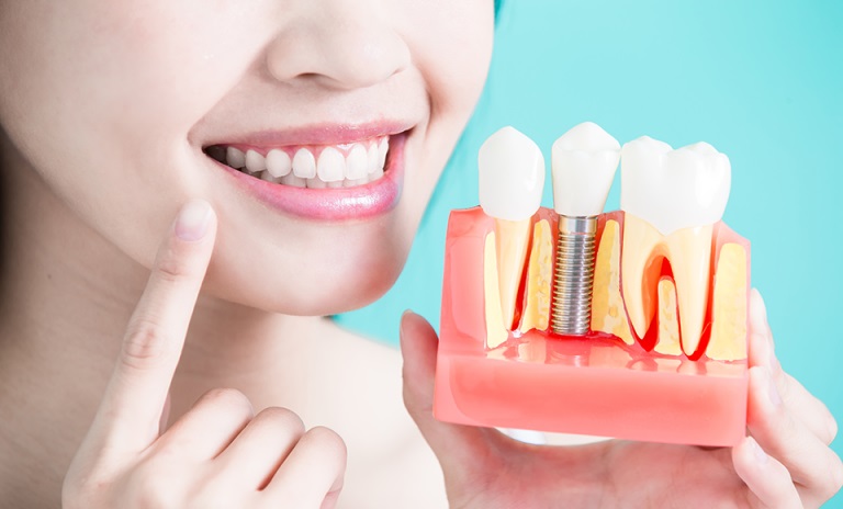 Подготовка к имплантации зуба