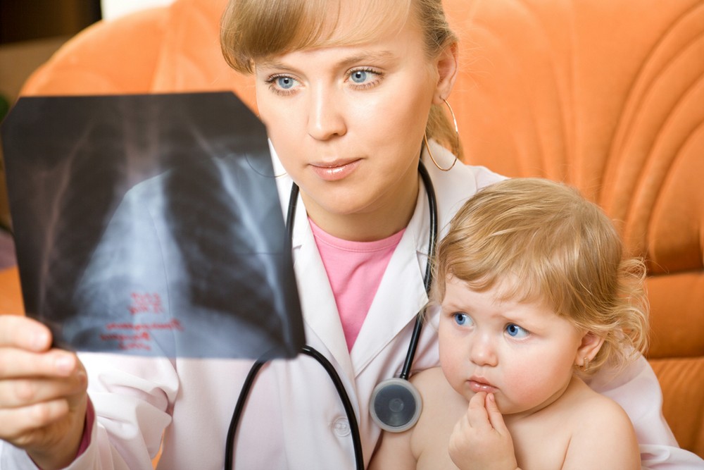 Пневмония у ребенка: симптомы и лечение
