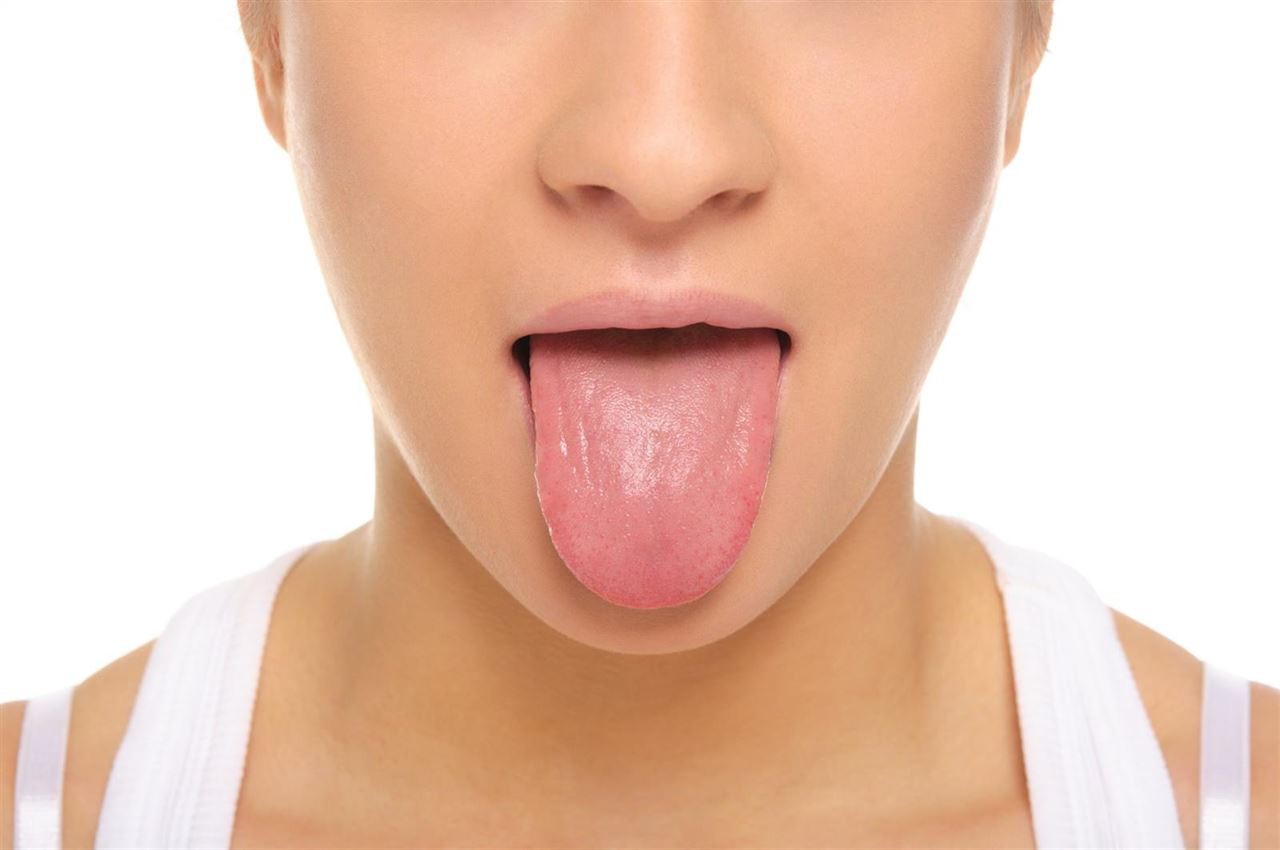 Глоссалгия: почему жжет язык
