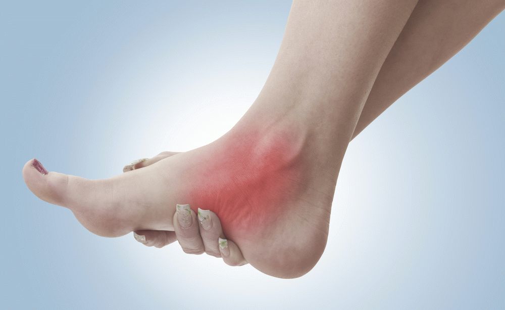 Метатарзалгия или почему болит подъем ноги