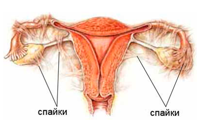 СПАЙКИ