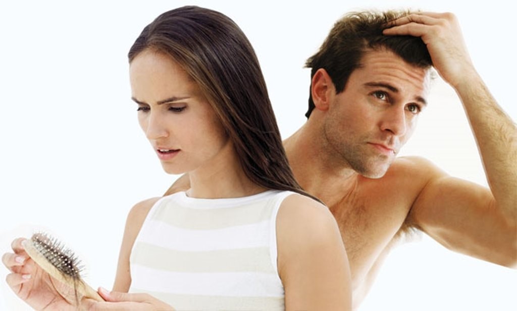 Выпадение волос у мужчин и женщин: методы лечения