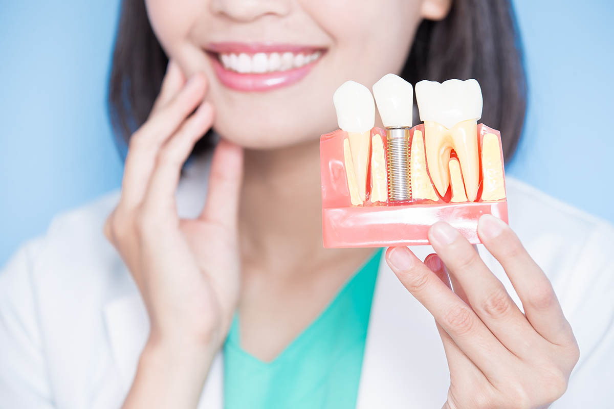 Подготовка к имплантации зуба: что спросить у стоматолога?