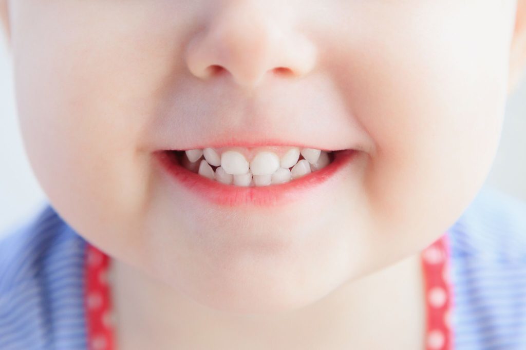 Молочные зубы: лечить или не лечить?