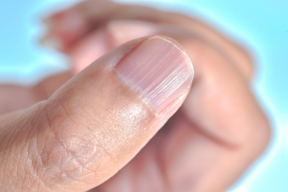 Ногти ребристые: почему, причины и что делать
