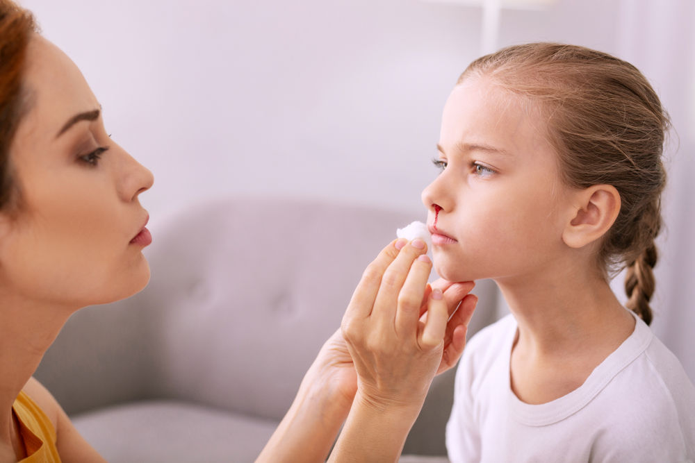 Носовое кровотечение у ребенка: как остановить