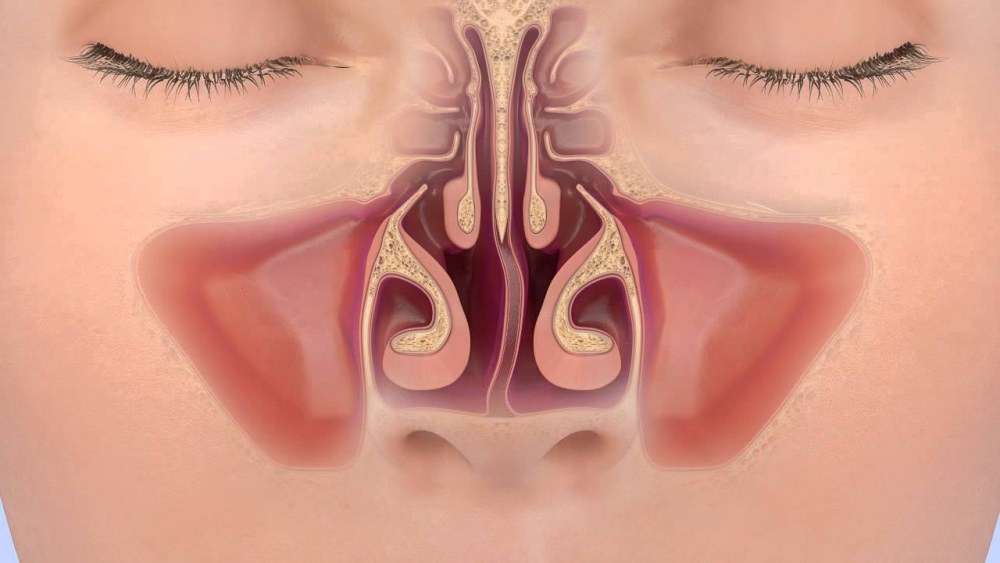 Искривление носовой перегородки: причины, симптомы, показания к операции