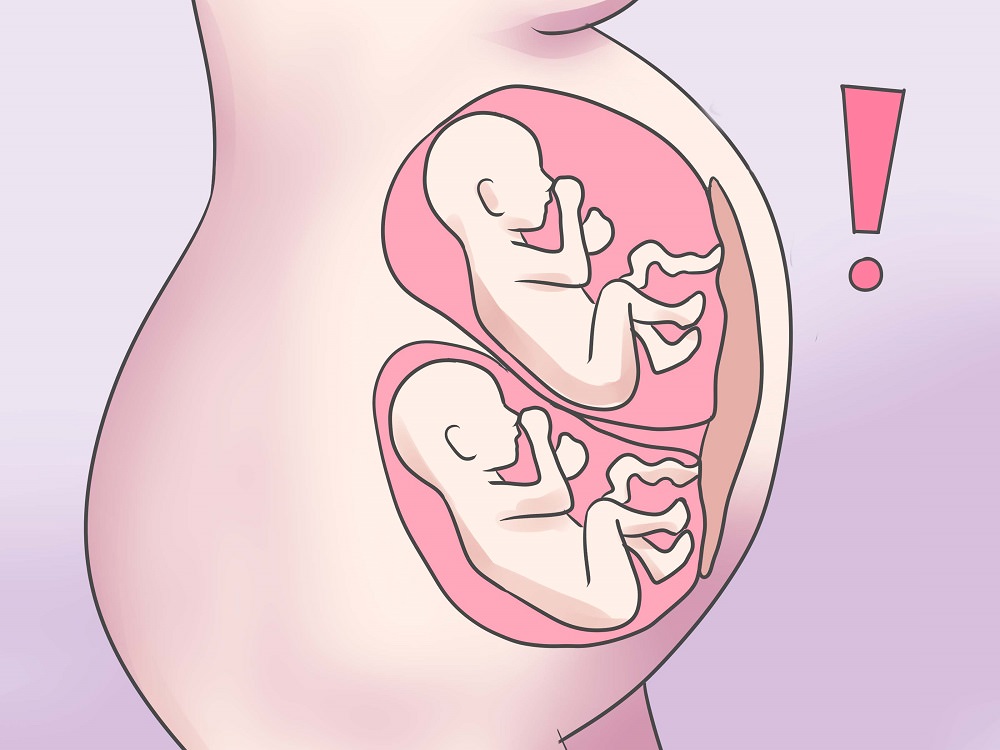 Многоплодная беременность: ее признаки и развитие плода