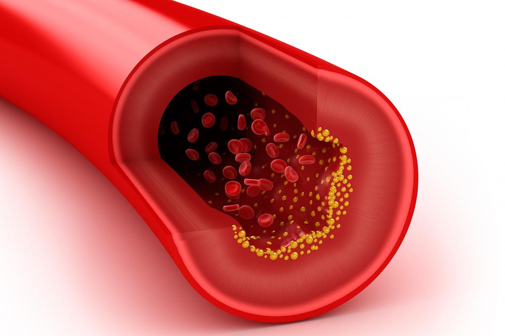 Как снизить уровень холестерина в крови простыми способами