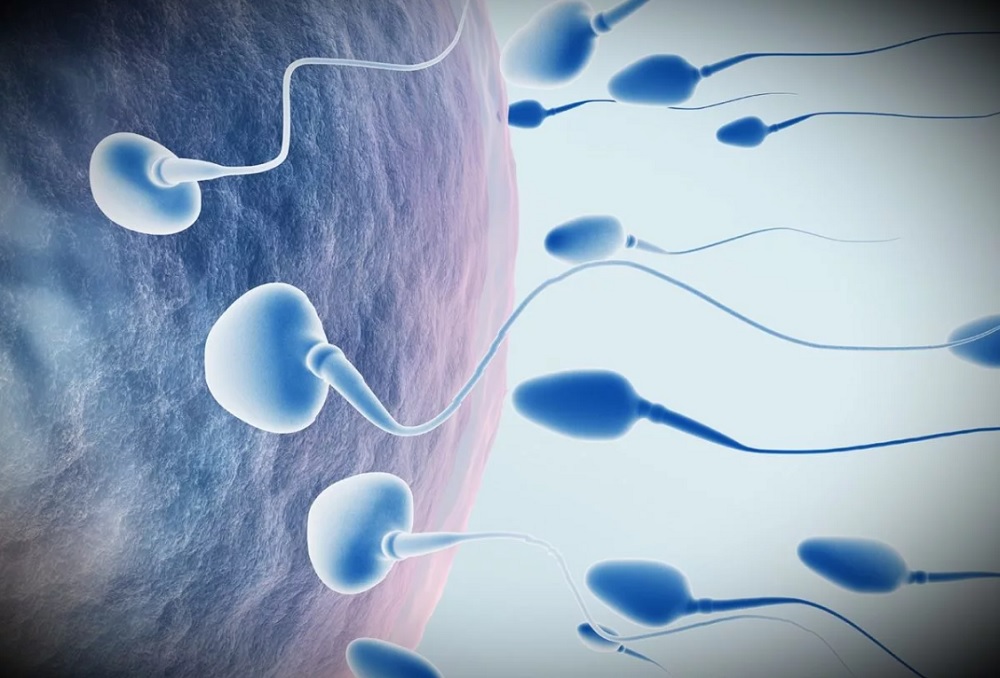 Что такое спермограмма