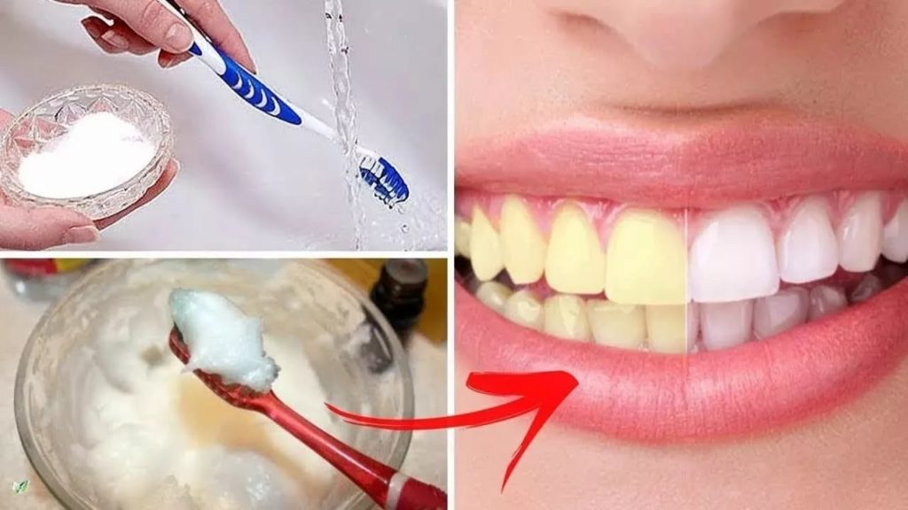 Отбеливание зубов содой